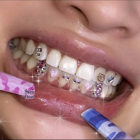 Female Grills, Teeth Jewels, Mouth Art, Teeth Gems, Giveaway Rules, Pretty Teeth, Tooth Jewelry, Grillz Teeth, Tooth Gems