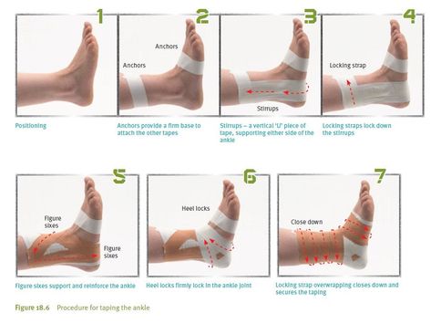 Taping and bandaging  Taping and bandaging Taping uses adhesive, often rigid, tape, while bandaging uses non-adhesive, often elasticised, bandages. Volleyball Taping, How To Tape Ankle For Support, Kt Tape Ankle Stability, Athletic Tape Ankle, Sports Tape Ankle, Kt Tape For Ankle Support, Ankle Kinesio Taping, Kt Tape Wrist Support, Kinesiology Taping Ankle Support