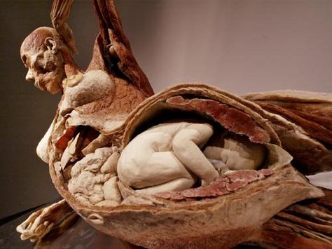 Cadaver3 F Gunther Von Hagens, Medical Things, Bizarre Art, After Life, Anatomy And Physiology, Anatomy Art, Human Anatomy, Body Health, Body Works