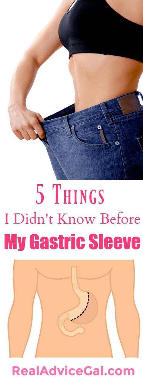 5 Things I Didn't Know Before My Gastric Sleeve - Real Advice Gal Sleeve Surgery Diet, Gastric Bypass Sleeve, Bariatric Recipes Sleeve, Gastric Bypass Diet, Stomach Sleeve, Vertical Sleeve Gastrectomy, Bariatric Sleeve, Bariatric Diet, Sleeve Gastrectomy