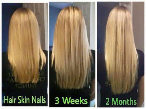 Hair Skin Nails. - biotin, keratin, essential vitamins and nutrients. www.skinnywrapsanddetox.com Hair Growth Challenge, Biotin Hair Growth, Biotin Hair, Hair Skin And Nails, Skin Nails, Super Hair, Grow Hair Faster, After Pictures, Trendy Hair Color