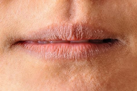 Signs You’re Not Getting Enough Vitamin B6 Vitamin B6 Deficiency Signs, Vitamin B Deficiency Symptoms, Vitamin B6 Deficiency, Vitamin B Deficiency, Foggy Brain, Linus Pauling, Dry Cracked Lips, Itchy Rash, Vitamin Deficiency