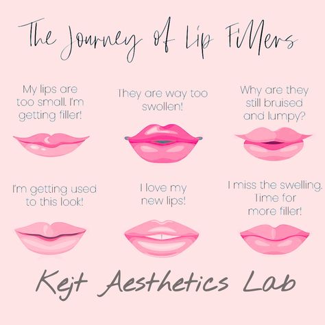 Embark on the journey of lip fillers with us at Kejt Aesthetics Lab! Let our skilled team guide you through the transformative experience of enhancing your lips. Discover the perfect pout you’ve always dreamed of. Book your appointment now! 💋💫 ✨www.kejtofficial.com ✨ #kejtaestheticslab #lipfillersjourney #lipfiller Lip Fillers, Shape Of You, Book Your Appointment, Your Lips, The Journey, Henna, Lab, Lips, Let It Be