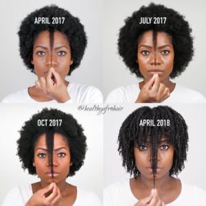 Hair Growth Black Women, 1 Year Hair Growth, Healthy Afro Hair, Afro Hair Growth, 4c Hair Growth, Natural Hair Journey Growth, Black Hair Growth, Hair Growth Women, Pelo Anime