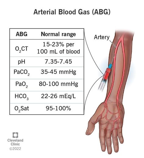 Arterial Blood Gases, Septic Shock, Arterial Blood Gas, Blood Test Results, Normal Values, Lung Conditions, Pulmonology, Respiratory Therapy, Organ System