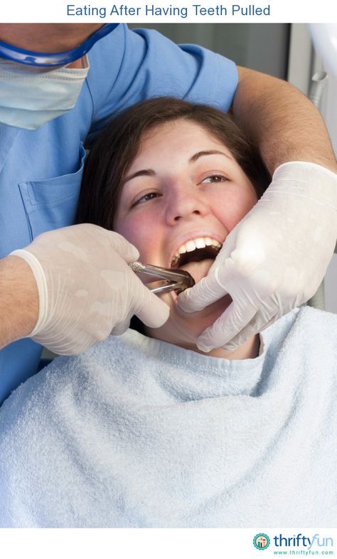 This is a guide about eating after having teeth pulled. Following your dentist's… Eating After Tooth Extraction, Food After Tooth Extraction, Soft Foods To Eat, Tooth Extraction Aftercare, Tooth Extraction Healing, Snap On Smile, Tooth Pulled, Bad Teeth, Dental Tourism