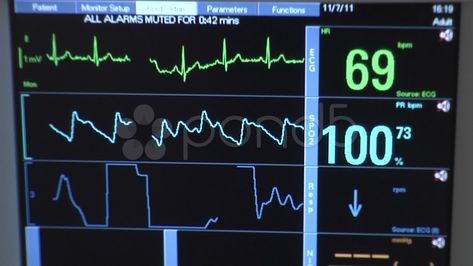 Medical EKG Heart Rate Monitor at Hospital - Close Up Stock Footage #AD ,#Heart#Rate#Medical#EKG Heartbeat Monitor Aesthetic, Heart Beat Machine In Hospital, Heart Monitor Aesthetic, Ekg Aesthetic, Hospital Heart Monitor, Jennifer Hartmann, Heartbeat Monitor, Heartbeat Line, At Hospital