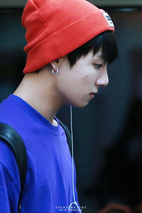 Jeon Jung Kook | Kookie | Jungkook | BTS Bangtan Boys/Sonyeondan Jungkook Acne, What I Want For Christmas, I Know What I Want, Acne Face, Bare Face, Jeon Jeongguk, Bts Korea, Jung Kook, Rap Monster