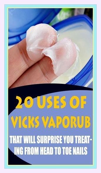 20 Great Uses of Vaseline Which You Probably Don’t Know Vaporub Uses, Uses Of Vaseline, Vicks Vaporub Uses, Uses For Vicks, Remove Unwanted Hair, Health Signs, Tongue Health, Vicks Vaporub, Unwanted Hair Removal