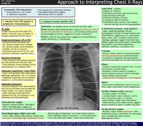 Chest X Ray, Chest Xray, Radiography Student, Diagnostic Medical Sonography Student, Physiotherapy Student, Medical Radiography, Radiology Student, Radiology Technician, Diagnostic Medical Sonography