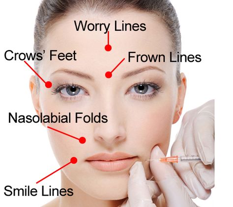 ANTI-AGING and SKIN CORRECTION BLOG: Botox® if applied to skin has no effect, so what is it with all the skin care products calling themselves “Botox® in a bottle”? Botox Forehead, Night Time Skin Routine, Botox In A Bottle, Anti Wrinkle Injections, Cosmetic Injectables, Injectables Fillers, Slimmer Face, Botox Fillers, Botox Injections