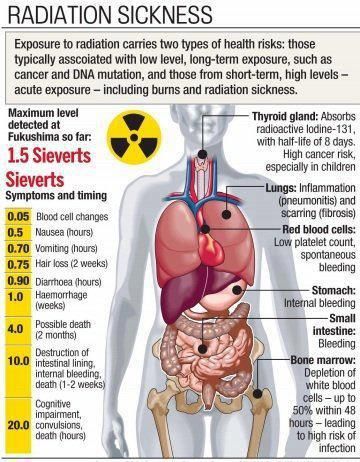 Medical Addicts: Acute radiation syndrome (ARS), also known as radiation poisoning, radiation sickness or radiation toxicity Chernobyl Facts, Radiation Poisoning, Radiation Therapist, Radiologic Technology, Radiology Technologist, Radiation Exposure, Nuclear Medicine, Thailand Art, Nuclear Disasters