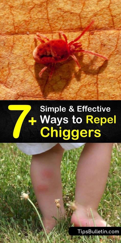 Learn how to repel chiggers and prevent an infestation. Chiggers inject enzymes in your skin which result in an itchy rash. Use an insect repellent and wear long pants to keep them at bay to… More Repellent Diy, Calamine Lotion, Itchy Rash, Lawn Care Tips, Diy Lotion, Outdoor Paradise, Essential Oil Blends Recipes, Fabric Spray, Natural Insect Repellant