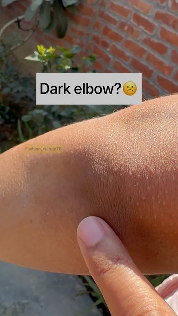 fashion_culture70 on Instagram: "Dark elbow?☹️ Try this remedy❤️ Follow @fashion_culture70 for more videos #reels #darknessremoval #darkneck #suntan #suntanremoval #skincaretips #glowup #haircare #viral #viralvideos #explore #instagram" Natural Skin Care Ingredients, Natural Skin Care Remedies, Diy Skin Care Routine, Natural Face Skin Care, Tips Skincare, Good Skin Tips, Basic Skin Care Routine, Perfect Skin Care Routine, Homemade Beauty