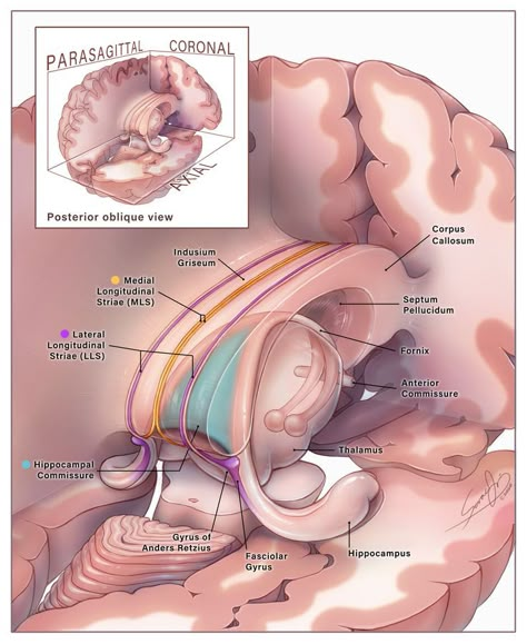 Corpus Callosum, Studying Medicine, Medicine Notes, Medicine Studies, Basic Anatomy And Physiology, Medical Posters, Medical Videos, Brain Anatomy, Medical Student Study