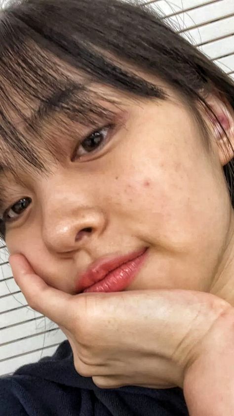 Kpop Idols Acne, Natural Skin Tone, Shin Ryujin, Bare Face, Aesthetic Japan, Beauty Photos, Body Inspiration, Black Pink Dance Practice, Without Makeup