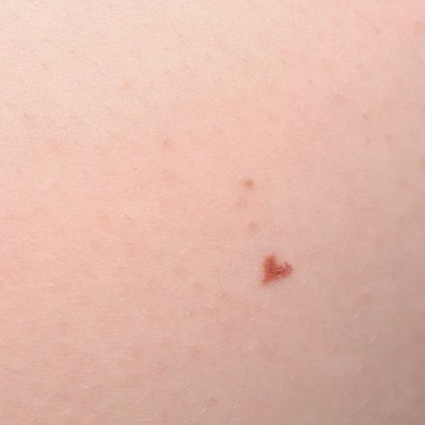 Heart Beauty Mark Tattoo, Heart Tattoo Freckle, Tattoo Beauty Mark, Heart Shaped Freckles, Heart Beauty Mark, Beauty Marks On Face, Beauty Mark Tattoo, Heart Freckle Tattoo, Heart Freckles