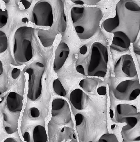 Human bone under Scanning Electron Microscope Human Body Under Microscope, Human Cells Microscope, Human Bone Structure, Bones Human, Bone Cells, Bone Texture, Nature Structure, Microscopic Cells, Microscope Pictures