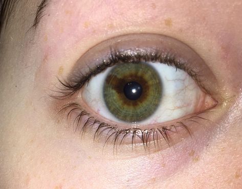 Green And Brown Heterochromia Eyes, Sectoral Heterochromia Green And Brown, Hetrochormia Eyes Brown And Green, Green And Brown Heterochromia, Sectoral Heterochromia Green, Green Brown Heterochromia, Heterochromia Eyes Brown And Green, Baggy Eyes Aesthetic, Heterochromia Eyes Aesthetic