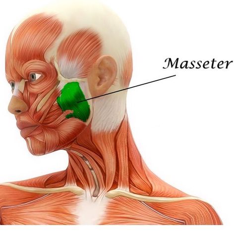 Muscles Of The Head, Supraspinatus Muscle, Infraspinatus Muscle, Masseter Muscle, Rectus Abdominis Muscle, Excessive Underarm Sweating, Sternocleidomastoid Muscle, Thoracic Cavity, Head Muscles