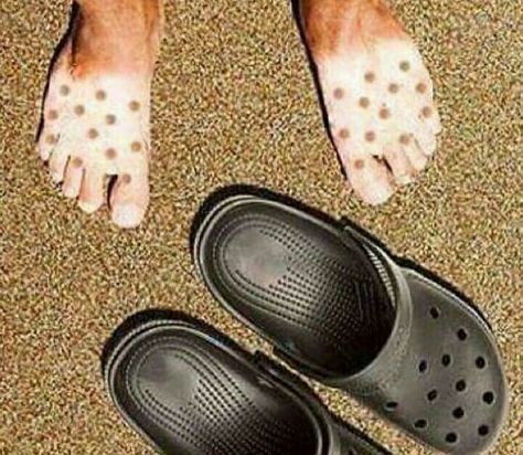 That's why i hate crocs Strange Photos, 웃긴 사진, Memes Humor, Funny People, Bones Funny, Funny Photos, Funny Cute, Funny Images, Really Funny