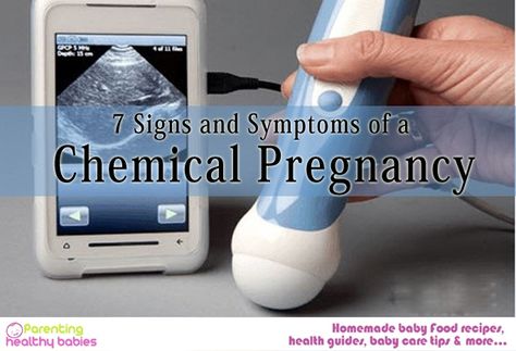 Pregnancy Signs And Symptoms, Chemical Pregnancy, Chromosomal Abnormalities, Hcg Levels, Abdominal Cramps, Stomach Cramps, Nerve Pain Relief, Pregnancy Signs, Baby Care Tips