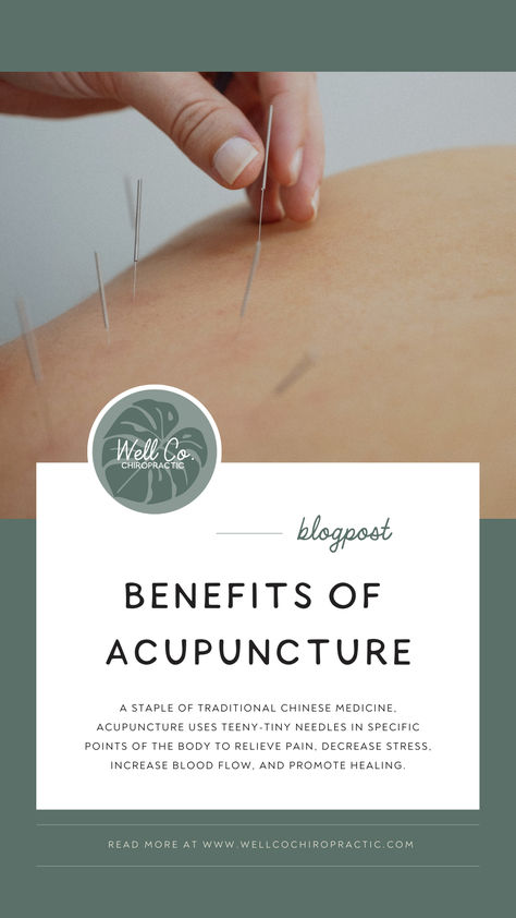 A staple of traditional Chinese medicine, acupuncture uses teeny-tiny needles in specific points of the body to relieve pain, decrease stress, increase blood flow, and promote healing. In this blog post, Dr. Sandy will explain all of the benefits acupuncture   has to offer- read more on wellcochiropractic.com 

#acupuncture #acupuncturebenefits #chiropractor #chiropractic #painrelief Acupuncture Quotes, Traditional Chinese Medicine Acupuncture, Acupuncture Benefits, Increase Blood Flow, Body Therapy, Sarasota Florida, Traditional Chinese Medicine, Healing Process, Chinese Medicine