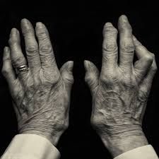 86 Year Old Hands | My granny's hands, arthritic and gnarled… | Flickr Hand Showing Something Reference, Old Hands Photography, Hands Photography Creative, Aged Hands, Finger Reference, Wrinkles Photography, Fingers Drawing, Hands Anatomy, Portfolio Painting