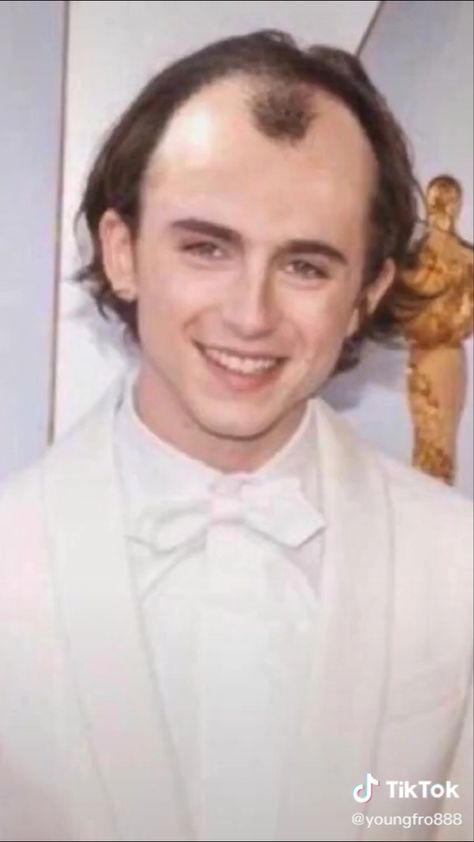 Ugly Celebrities, Timothee Chalamet Boyfriend Material, Timothee Chalamet Funny, Worst Hairstyles, Ugly Meme, Somewhere In Northern Italy 1983, Edited Pictures, Ugly Photos, Meme Random