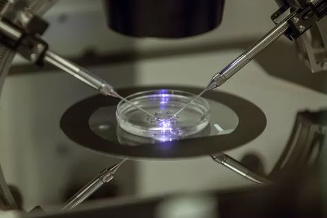 Future of IVF? Scientists work to create babies without egg, sperm Ivf Procedure, Sperm Donor, Ivf Cycle, Genetic Diseases, In Vitro Fertilization, In Vitro, Genetic Testing, High Court, Parents Baby