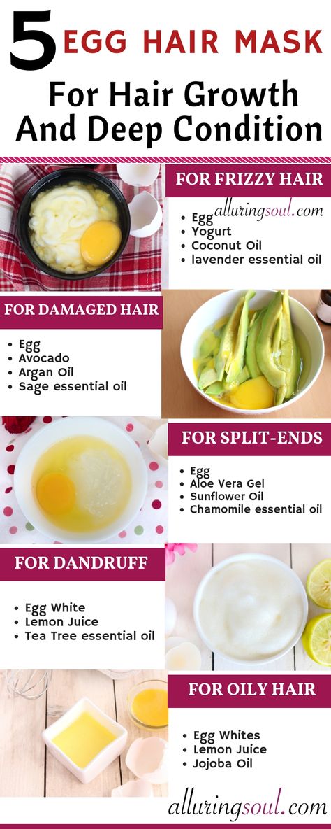 Egg is the boon for dry, frizzy and damaged hair. Eggs can make your hair soft, shiny and manageable and also helps in hair growth. Hair Mask For Shiny Soft Hair, Egg Hair Mask, Egg Mask, Oils For Dandruff, Egg For Hair, Hair Mask For Damaged Hair, Brown Spots On Face, Diy Hair Mask, Home Remedies For Hair