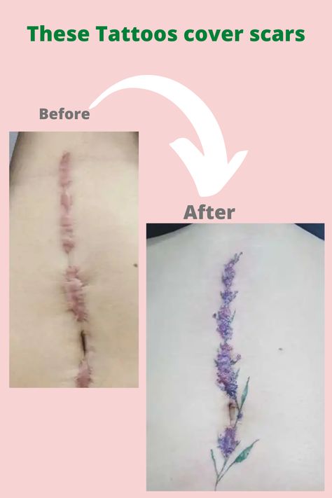 #ScarCoverupTattoos #TattooTransformation #ScarTattooArt #InkOverScars #HealingInk #BodyArtHealing #ScarCamouflage #TattooHealingJourney #InkedCoverup #ScarArtistry #TattooedScars #CreativeCoverups #EmpoweringInk #ScarToArt #InkTherapy Knee Tattoo To Cover Scar, Straight Scar Tattoo, Surgery Tattoo Cover Up, Tattoo To Cover Ankle Scar, Tattoo Over Knee Scar, Spine Tattoos To Cover Scar, Knee Surgery Tattoo Cover Up, Ankle Tattoo Scar Cover, Knee Replacement Scar Tattoo