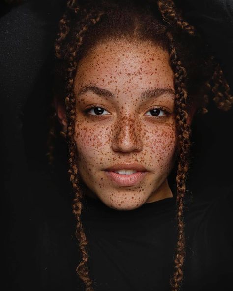 Poc Redhead, Black With Freckles, Female Redhead, Black Redhead, Black Girls With Freckles, Black Freckles, Freckle Photography, Girl With Freckles, Beautiful Black Queen