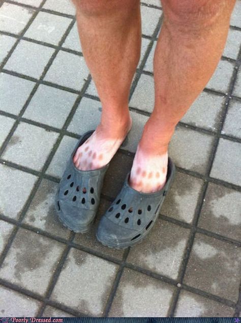 Crocs are stupid and gross White People Problems, Funny Commercial Ads, Funny Commercials, 밈 유머, Bad Taste, 웃긴 사진, Have A Laugh, Laughing So Hard, Tan Lines