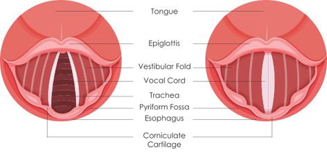 Vocal Nodules and Vocal Health Hearing Loss Remedies, Vocal Health, Vocal Technique, Using Your Voice, Vocal Cords, Ear Anatomy, Vocal Chords, Vocal Training, Use Your Voice