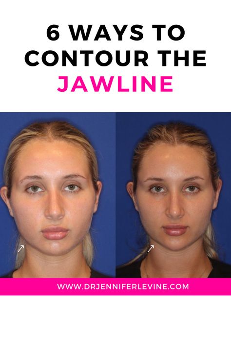 Defining the jawline can help enhance facial symmetry, provide a slimming effect, and reduce the appearance of jowls. Here are some jaw slimming options to get you started! Slim Your Face, Facial Symmetry, Health Transformation, How To Contour, Square Faces, Health Challenge, Fashion Face, Facial, Square