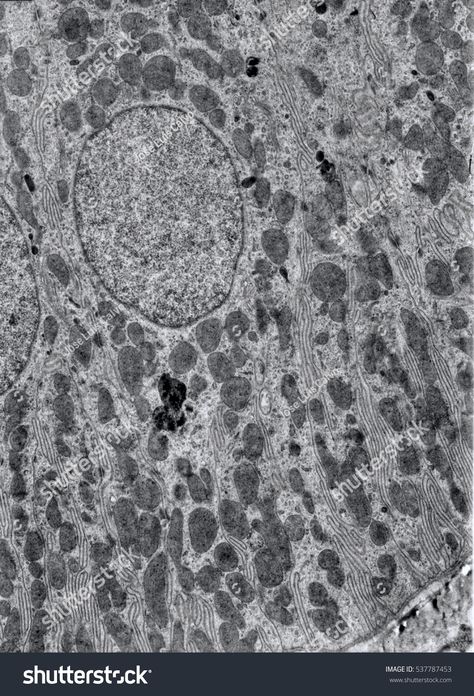 Transmission electron microscope (TEM) micrograph showing of a kidney convoluted tube cell. The basal infoldings with numerous mitochondria associated can be seen. Dense bodies are lysosomes. Electron Microscope, Stock Photos, Illustrations