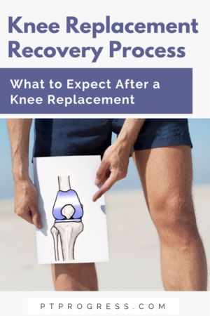 Pt For Knee Replacement, Exercises For Knee Replacement Patients, Recovering From Knee Replacement Surgery, Exercise After Knee Replacement, Exercises After Knee Replacement Surgery, Knee Replacement Humor, Knee Replacement Recovery Tips, Knee Replacement Pain, Knee Replacement Surgery Recovery