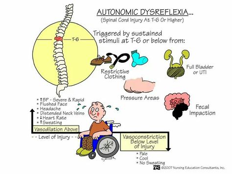 Autonomic Dysreflexia Nursing Neuro, Neuro Nursing, Autonomic Dysreflexia, Nursing Study Tips, Medical Assisting, Concept Maps, Nursing Board, Med Surg Nursing, Nclex Prep