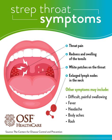 What to know about strep throat | OSF HealthCare Strep Throat Symptoms, Scratchy Throat, Throat Pain, Throat Infection, Sick Remedies, Strep Throat, Healing Waters, Hand Hygiene, Sinus Infection