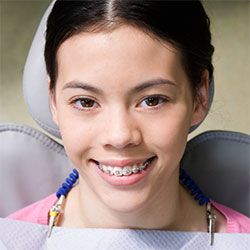 The first week or two of wearing braces is usually the most uncomfortable and requires the most adjustment of any other time of wearing braces. You are First Time Braces, Braces Journey, First Week, One Week, Braces, First Time, The First