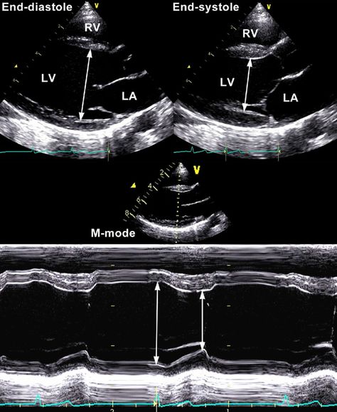 Echocardiography Aesthetic, Echo Sonography, Diagnostic Medical Sonography Student, Cardiac Anatomy, Cardiac Sonography, Medical School Interview, Sonography Student, Ultrasound Sonography, Medical Ultrasound