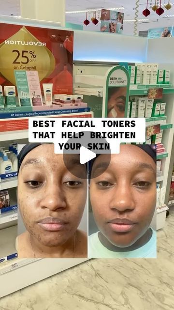 Rosemond Tettey on Instagram: "Best facial toners that helps brighten your skin!! #skincare #skincareroutine #facialtoner #clearskin #skincaretips #instagramreels #skintreatment #foryou #fyp #beautytips #skincareaddict" Best Toner For Combination Skin, Best Face Toner, Best Facial Toner, Rose Water Toner, Best Toner, Oily Face, Skin Redness, Skin Skincare, Toner For Face