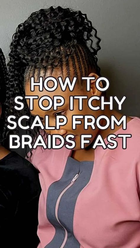 Itchy Scalp After Braids: Here's Why and How To Stop It - Hairshepherd After Braids Hair Care, Itchy Scalp Remedy, Sores On Scalp, How To Make Braids, Scalp Itch, Scalp Braids, Dry Itchy Scalp, Tight Braids, Black Hair Extensions