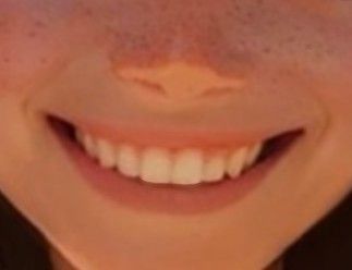 Perfect Teeth Aesthetic Korean, Sharp Canine Teeth Human Aesthetic, Teeth Claims For Dr Sharp, White Smile Aesthetic, Sharp Canines Human, Smile Claim For Dr, Teeth Claims For Dr, Teeth Claim, Perfect Smile Aesthetic