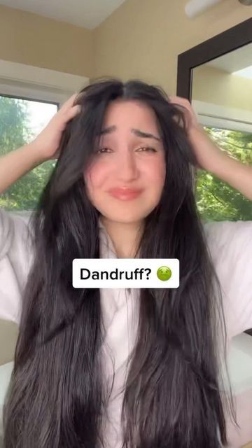 Camelia Katoozian on Instagram: "DIY remedy for dandruff, itchiness, and a dry scalp! 💆🏻‍♀️ This remedy will help get rid of dandruff and will encourage hair growth at the same time! It also strengthens the hair and adds shine ✨ 1️⃣ 1 part apple cider vinegar + 1 part water + 10 drops of tea tree oil (optional) 2️⃣ Pour ingredients into a spray bottle 3️⃣ Spray all over scalp and hair and continue to massage scalp 4️⃣ Leave this on for an hour then wash hair normally with shampoo 5️⃣ Enjoy t Essential Oils For Dandruff, Remedy For Dandruff, How To Remove Dandruff, Rid Of Frizzy Hair, Severe Dandruff, Dandruff Causes, Dandruff Solutions, Oils For Dandruff, Rid Of Dandruff