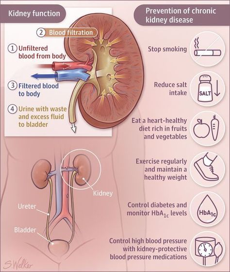 Improve Kidney Function, Kidney Pain, Creatinine Levels, Kidney Function, Renal Diet, Chronic Kidney, Kidney Health, Nursing Notes, Medical Knowledge