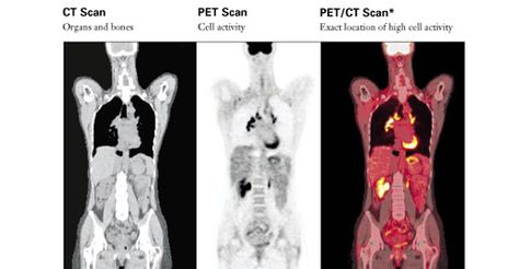 Animal Radiology, How To Read Mri Scans, Ct Scan Brain Anatomy, Diagnostic Radiography, Brain Tumour Ct Scan, Pet Ct, Pet Scan, Nuclear Medicine, Mri Scan