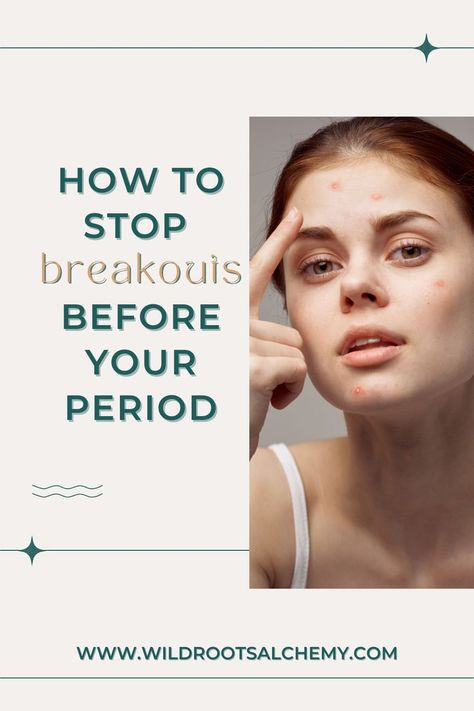 Premenstrual acne, or acne that occurs right before your period, is so common! Here are my top 8 tips for stopping those pre-period breakouts. Period Acne Tips, How To Stop Breakouts, Menstrual Acne, Period Breakouts, Period Acne, Period Pimples, Gelatin Gummies, How To Stop Period, Face Breaking Out