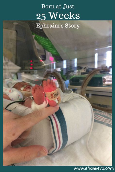 25 Weeks Gestation: Ephraim's Story - Shann Eva's Blog 28 Week Preemie, 32 Week Preemie, Nicu Baby Pictures, Preemie Babies Pictures, Newborn Survival, Preterm Baby, 25 Weeks Pregnant, Angel Dresses, Sweet Pictures